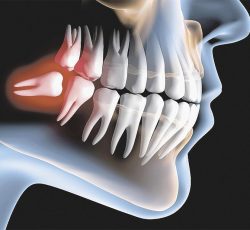 Cirurgia Oral Facial