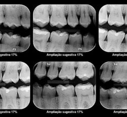 Radiografia Específica