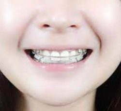 Aparelho Ortopédico Infantil