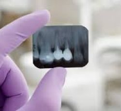 Radiografia Legalizada